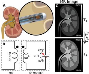 Radio frequency sensing‐based in situ temperature measurements during magnetic resonance imaging interventional procedures